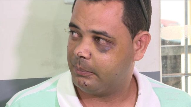 Servidor Anderson Pereira teve alta hospitalar e pede por justiça