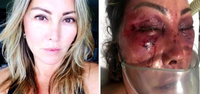 Elaine Perez Caparroz antes e depois das agressões